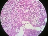acute-inflammation-6