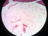 Adipose Tissue -6