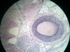 artery-3