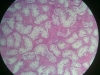atrophy-5-partial