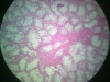 atrophy-6
