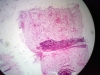 sympathetic-ganglion-1