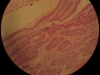 basal-cell-carcinoma-40x