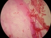 calcification-5-muscles-10x