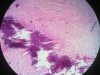 calcification-7-skin