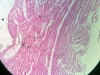 cardaic-muscle-1