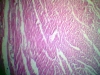 cardiac-muscle-3