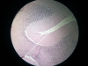 cerebellum-2