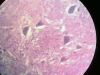 cerebral-cortex-5