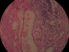 chronic-inflammation-40x