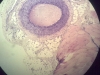Artery