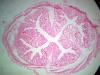 colon-1