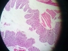 colon-2