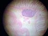 colon-4