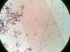 decalcified-compact-bone