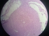 liver-congestion-x10