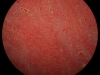 lungs-congestion-10x
