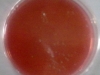 crystal-mac-conkey-3