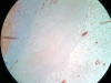 Dense regular connective tissue -3