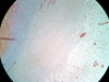 dense-regular-connective-tissue