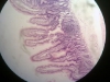 Duodenum-1