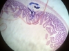 Duodenum-3