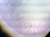 Duodenum-4