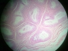 epididymus