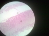 Simple columnar epithelium