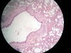 simple-squamous