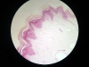 Stratified squamous epithelium