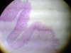 esophageal-stomach-junction
