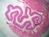 esophagus-1