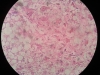 fatty liver-40x