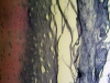 Fibrocartilage -6