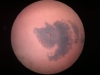 Chronic gastritis-giemsa-4x