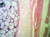 hyaline-cartilage-2