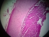 Hyaline cartilage -6