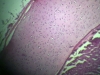 Hyaline cartilage -8