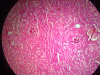 hydropic-change-1
