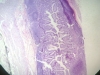 illeum-1