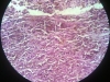 melanin-2
