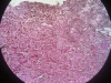 melanin-4