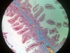 jejunum-2