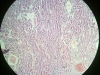 kidney-2