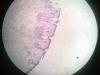 Lip -7