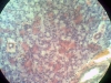 lung-2