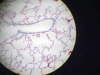 resp-bronchiole