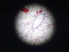 terminal-bronchiole
