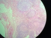 lymph-node-2
